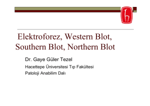 Elektroforez, Western Blot, Southern Blot, Northern Blot