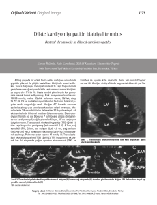 Dilate kardiyomiyopatide biatriyal trombus