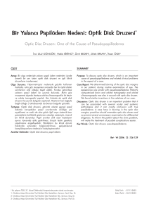 Bir Yalancı Papilödem Nedeni: Optik Disk Druzeni - Retina
