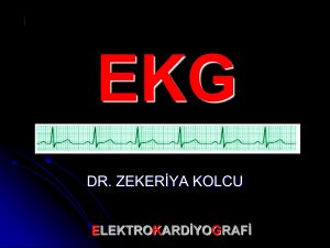 EKG