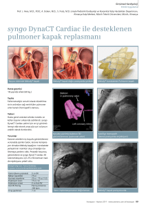 syngo DynaCT Cardiac ile desteklenen pulmoner kapak replasmanı