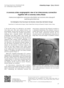 A coronary artery angiographic view of an intercoronary connection