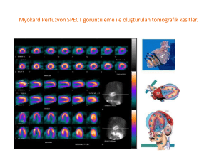 Myokard Perfüzyon SPECT görüntüleme ile olu*turulan tomografik