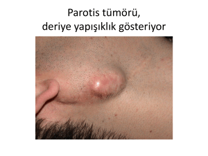 Parotis(tükrük bezi) tümörü cerrahisi ( ppt)