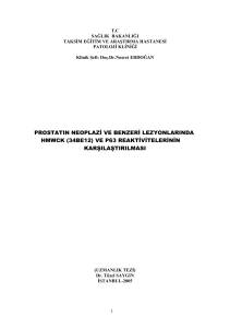 prostatın neoplazi ve benzeri lezyonlarında hmwck (34be12)