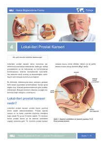 Lokal-ileri Prostat Kanseri - EAU Patient Information