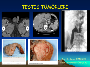 testis tümörleri - Fırat Üniversitesi