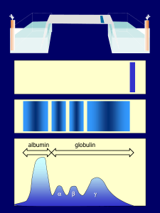 albumin globulin a      b       g