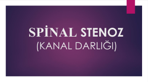 spinal stenoz