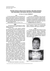 travma sonucu kırılan üst santral dişlerde orijinal diş parçasının yeni