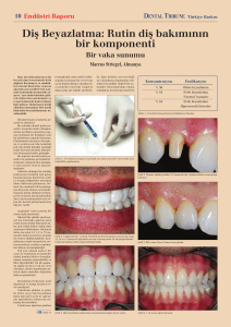 Diş Beyazlatma - Dental Tribune International