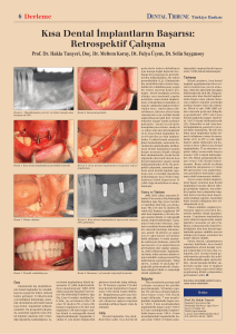 Kısa Dental İmplantların Başarısı: Retrospektif Çalışma