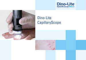 Dino-Lite CapillaryScope - Dino