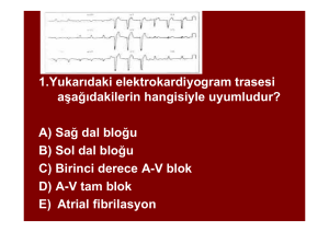 1.Yukarıdaki elektrokardiyogram trasesi aşağıdakilerin hangisiyle